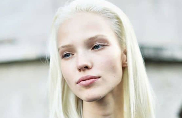 NORDIC BLONDE. WHAT YOU NEED TO KNOW.